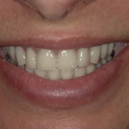 Smile again 2022 4