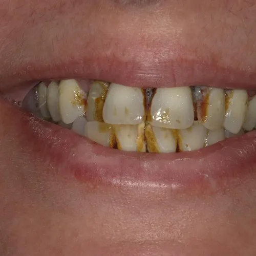Smile again 2022 5